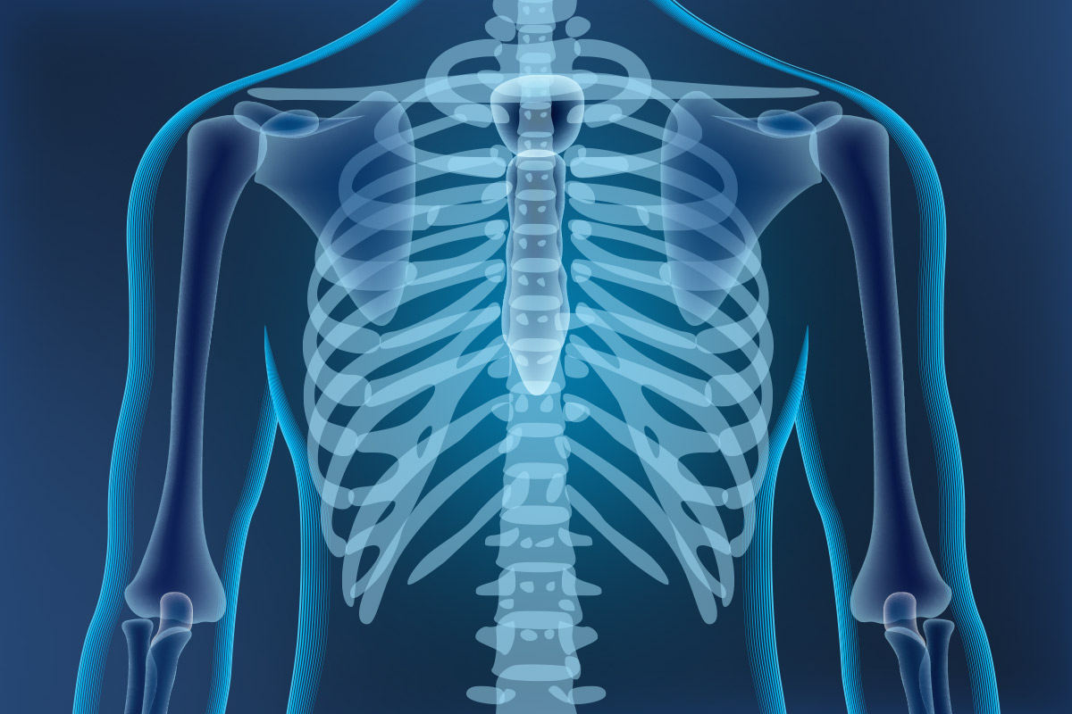 X-ray Image