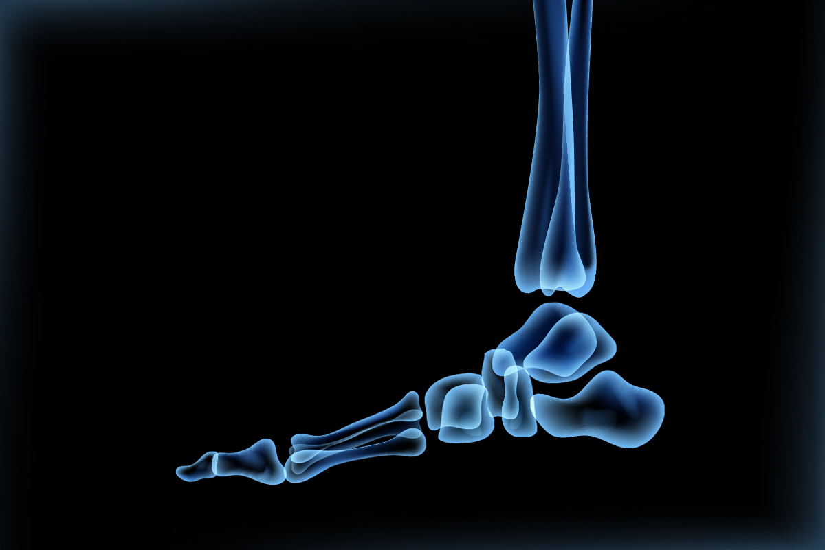 X-ray Image